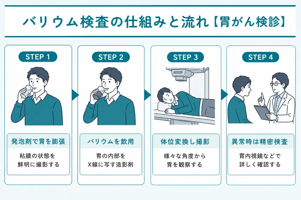バリウム検査は胃をX線で観察する胃がん検診の方法