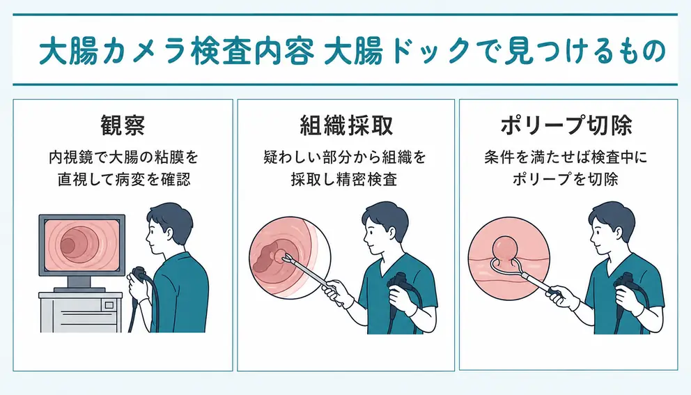 大腸カメラの検査内容は観察と組織採取とポリープ切除