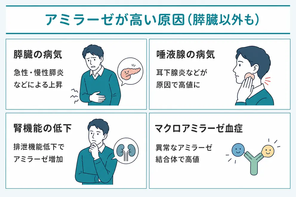 アミラーゼが高い原因は膵臓の病気だけではない