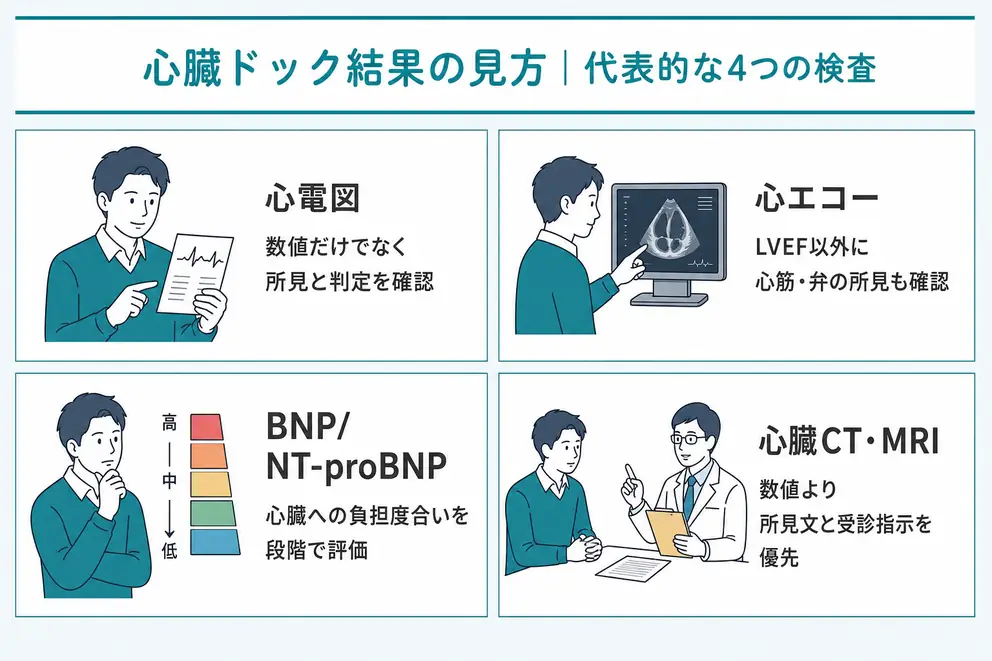心臓ドックの結果票で確認したい代表的な4つの検査