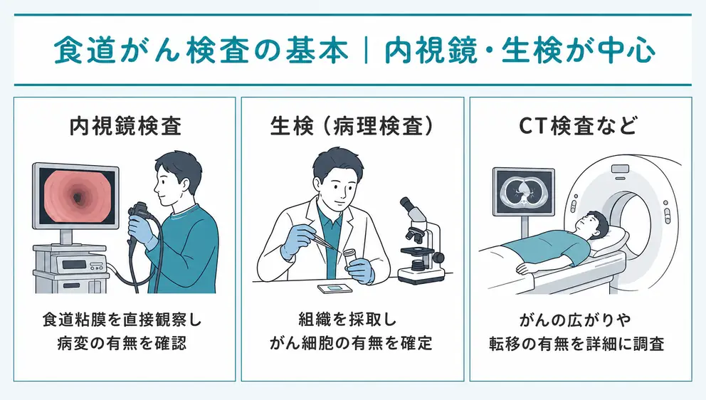 食道がん検査は内視鏡と生検を中心に進める