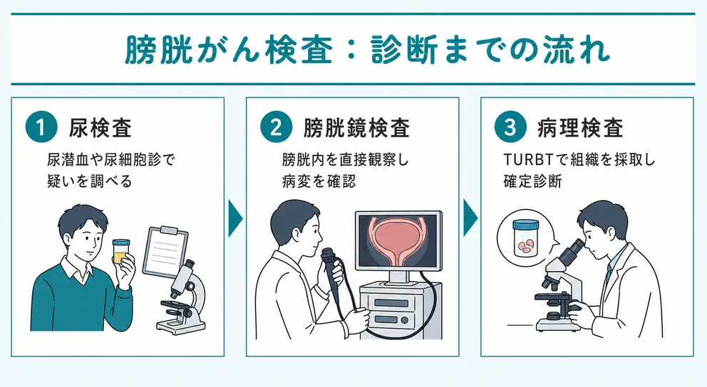 膀胱がんの検査では膀胱鏡と病理検査まで含めて診断する