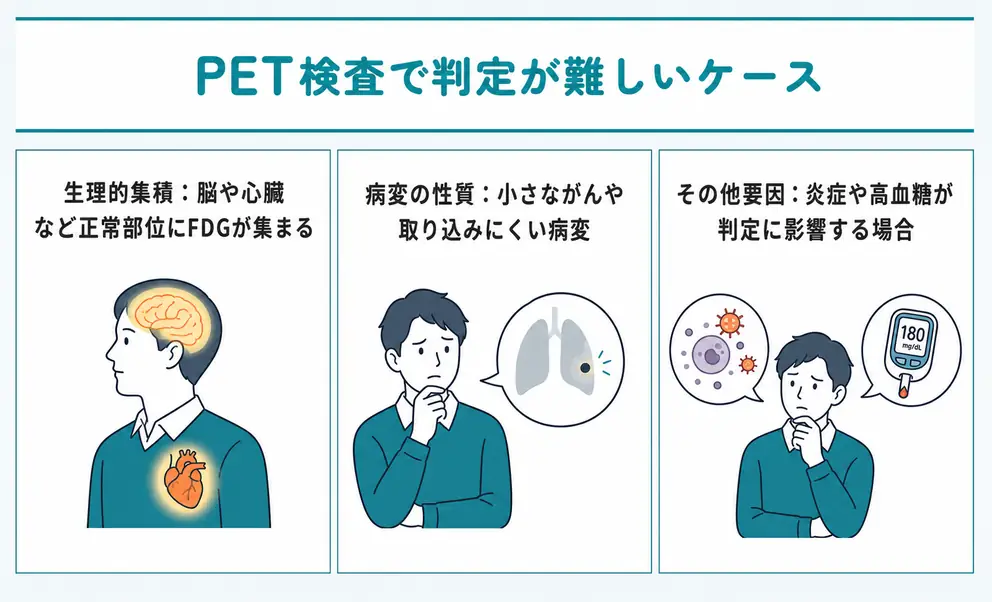 PET検査では生理的なFDG集積や病変の性質によって判定しにくい場合がある