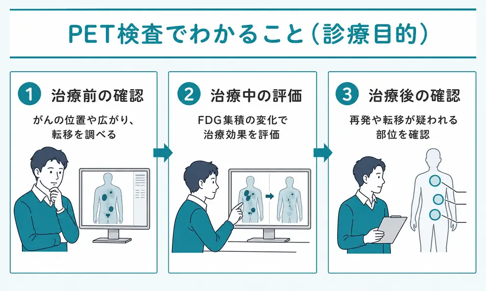 PET検査でわかることはがんの位置と広がりや治療後の変化