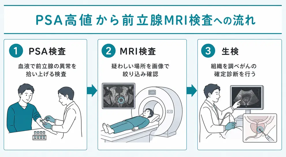 PSA高値から前立腺MRI検査へ進む流れ