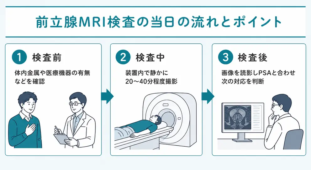 前立腺MRI検査は問診後に装置内で20分から40分程度撮影する