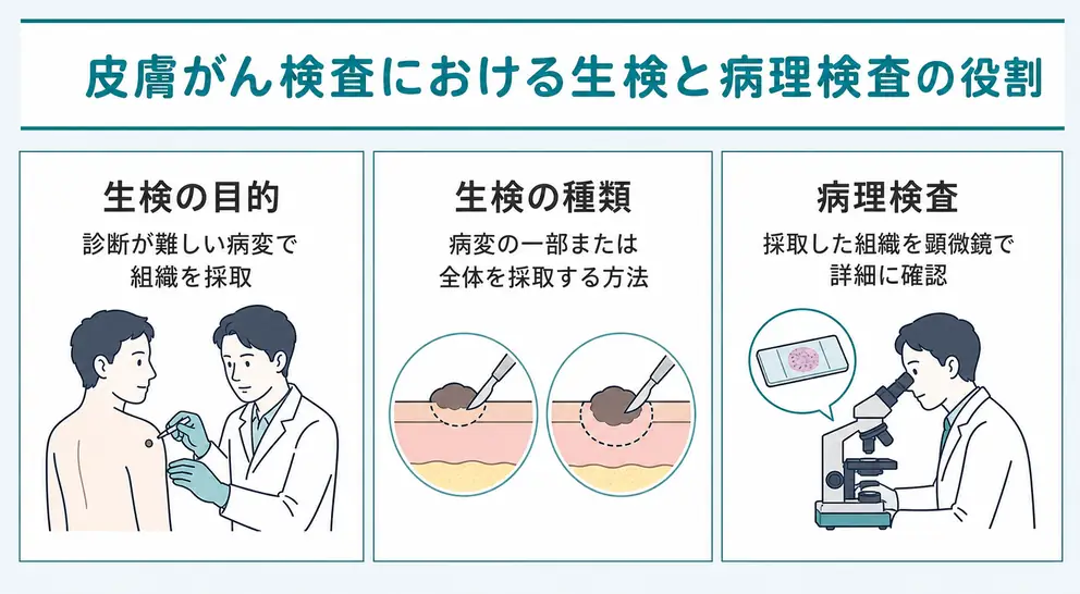 皮膚がん検査で生検が必要になる場合と病理検査の内容