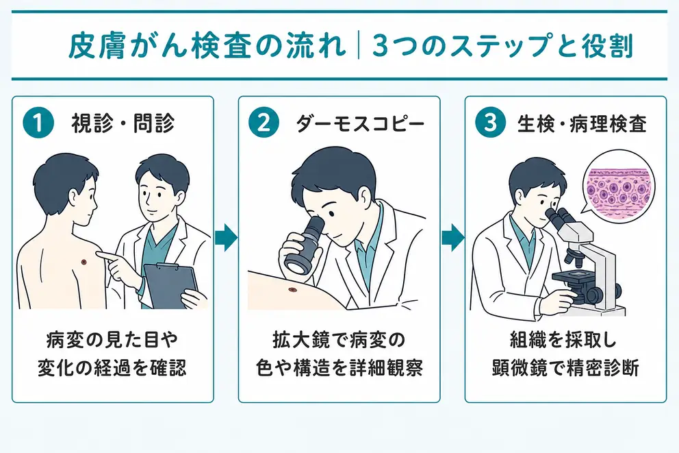 皮膚がん検査は視診・ダーモスコピー・生検を組み合わせて行う